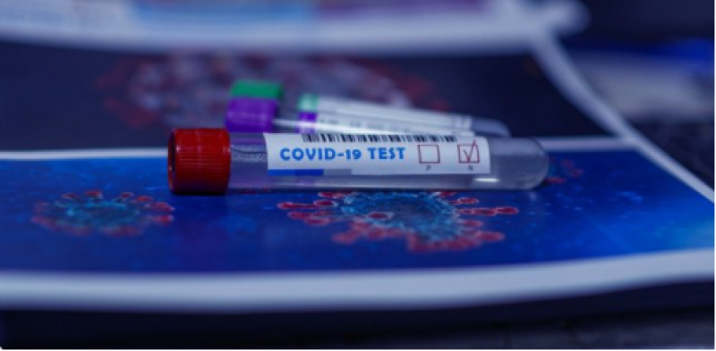 <span style='color:#780948'>ARCHIVED</span> - Spain develops pioneering test for Covid immunity